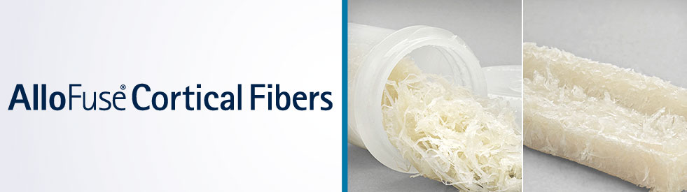 AlloFuse Cortical Fibers