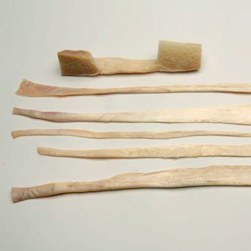 AlloConnex Tendons